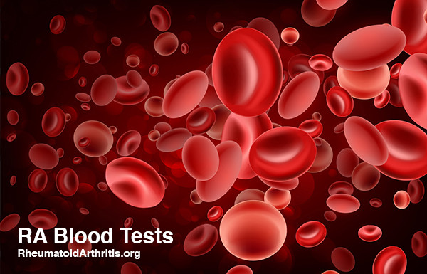 RA Blood Tests