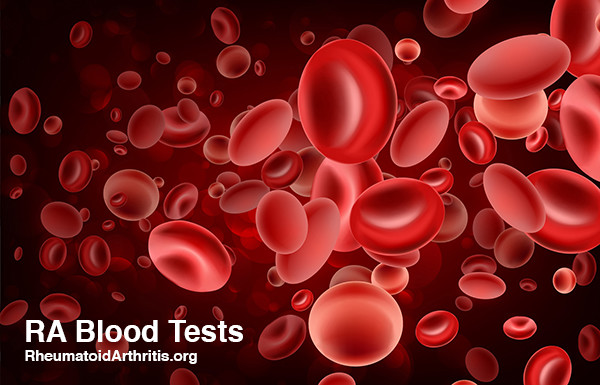 when to test for rheumatoid arthritis