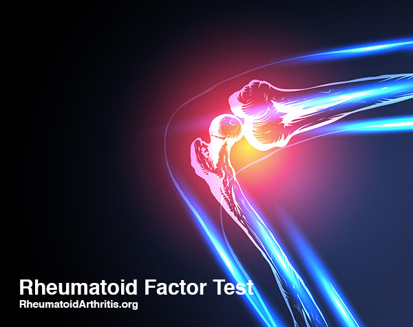 Rheumatoid Factor Levels Chart